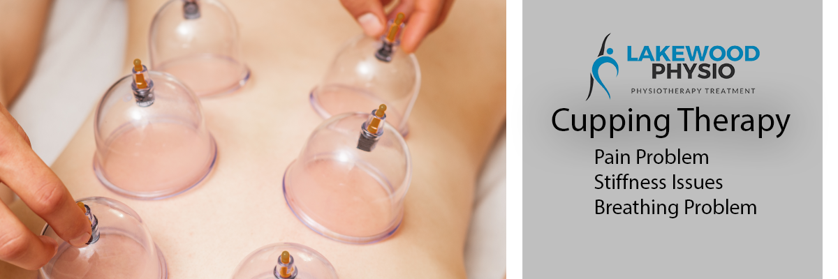 Cupping Therapy Lakewood Physio